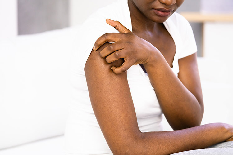 atopiskt-eksem-thumb